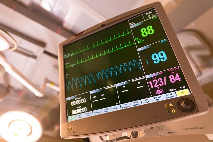 TEE Cardioversion Association Of Hospital Anesthesiologists